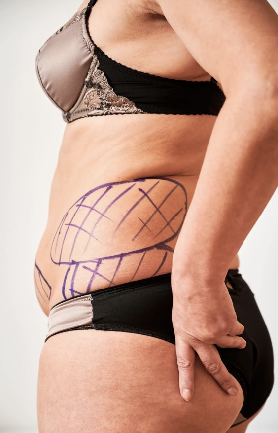 Body Surgery